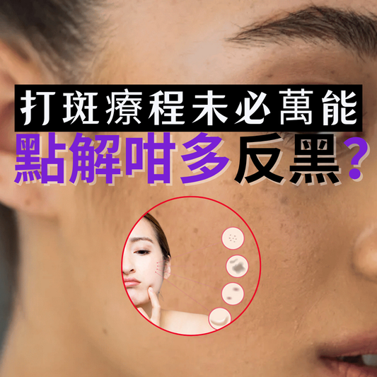 【色斑真相】女生最怕嘅「反黑」輪迴