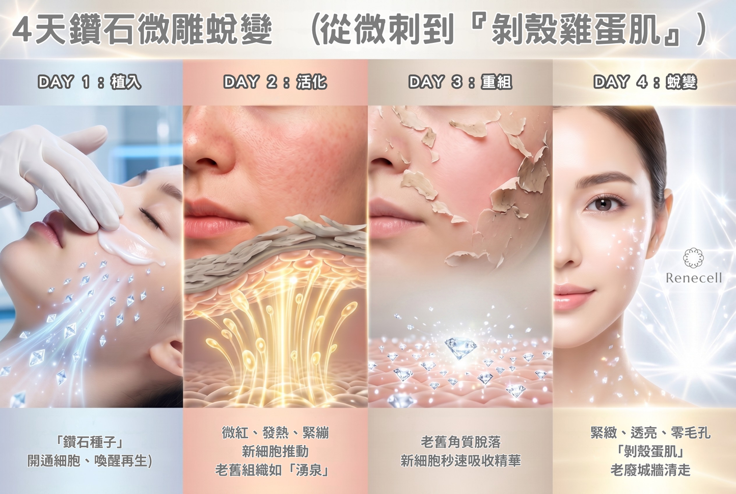 💎 鑽石煥膚療程 - 專人植鑽版