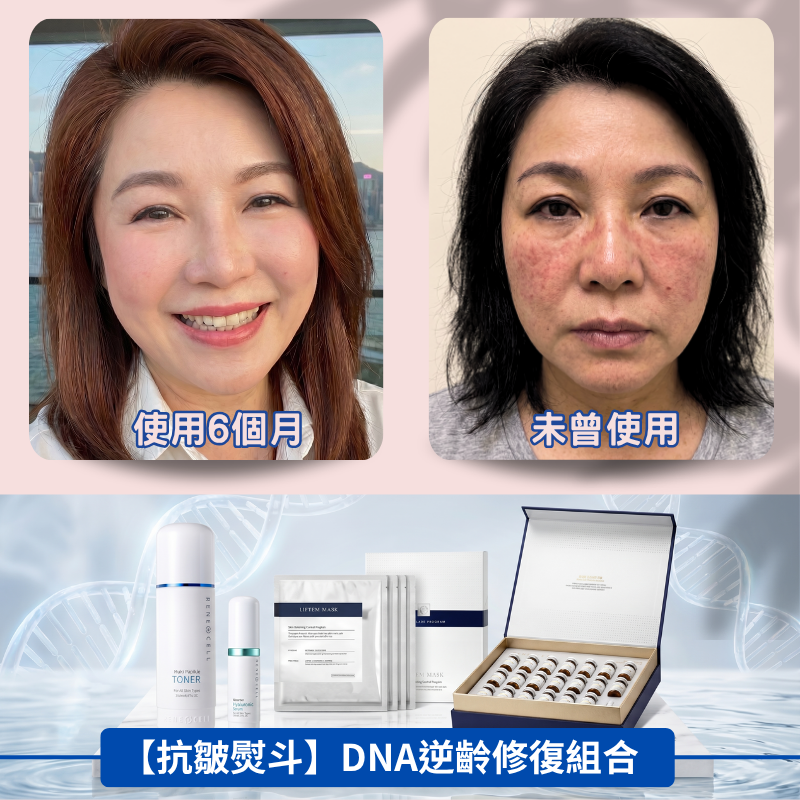 【抗皺熨斗】DNA逆齡修復組合