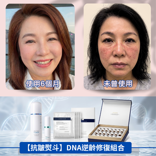 【抗皺熨斗】DNA逆齡修復組合